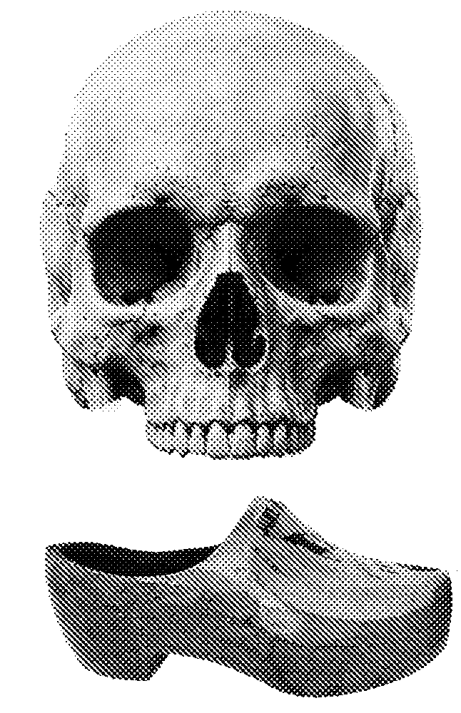 Skull and sabot illustration